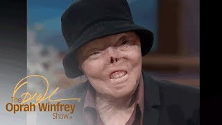 The Woman Who Was Burned Alive By A Drunk Driver | The Oprah Winfrey Show | Oprah Winfrey Network