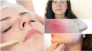 How To Treat Acne/Redness/Bumps After Waxing | वैक्सिंग के बाद लालिमा | zK BeautyCorner