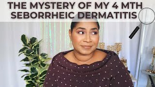 I can't believe this caused my Seborrheic Dermatitis!! Supplements? Stress? Dust? |SheriApproved