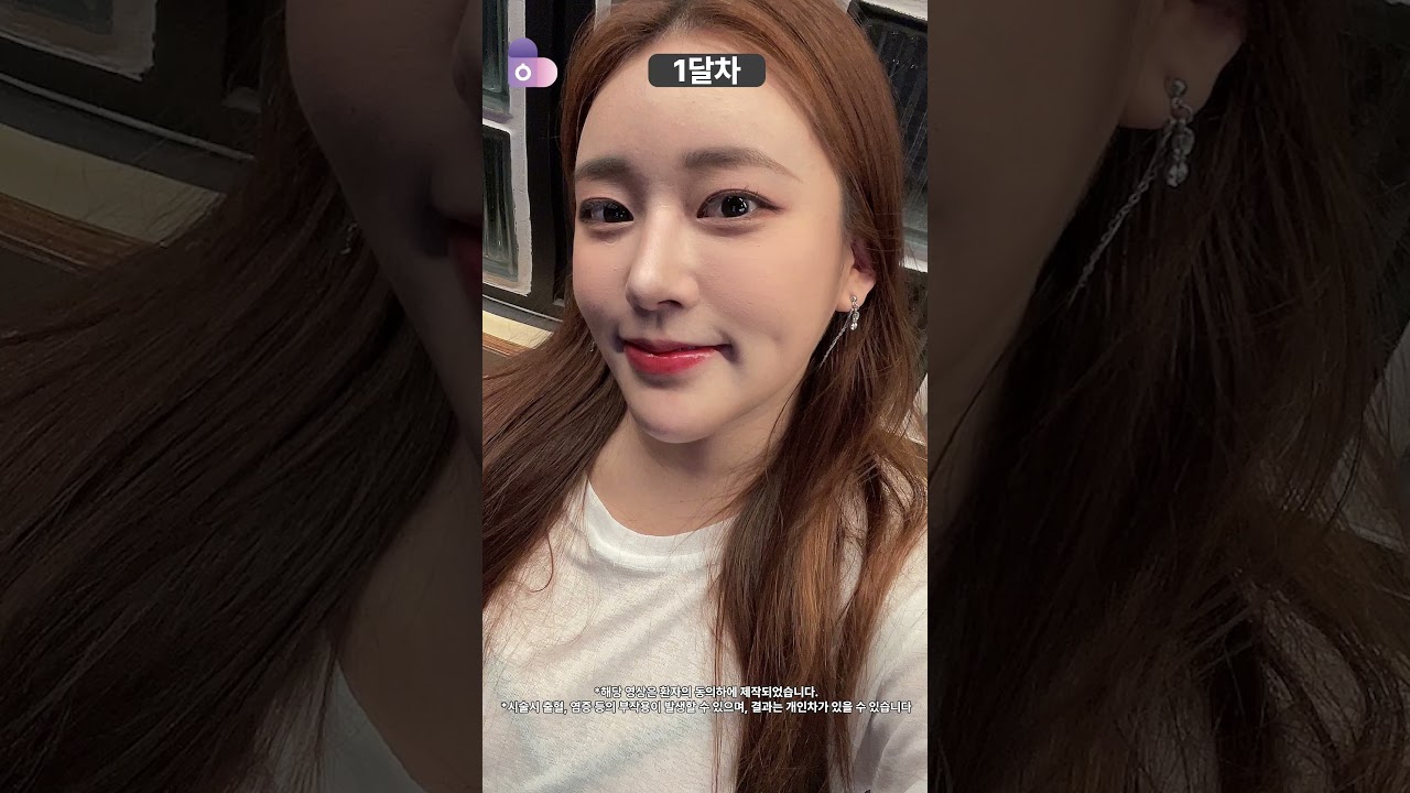 클로즈업이 증명하는 '코 라인'