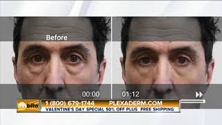 Get Rid of Crow’s Feet and Fine Lines with Plexaderm Skincare