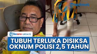 Potret Perempuan Penuh Luka Diduga Disiksa Oknum Polisi 2,5 Tahun, Dipaksa Racik & Pakai Narkoba