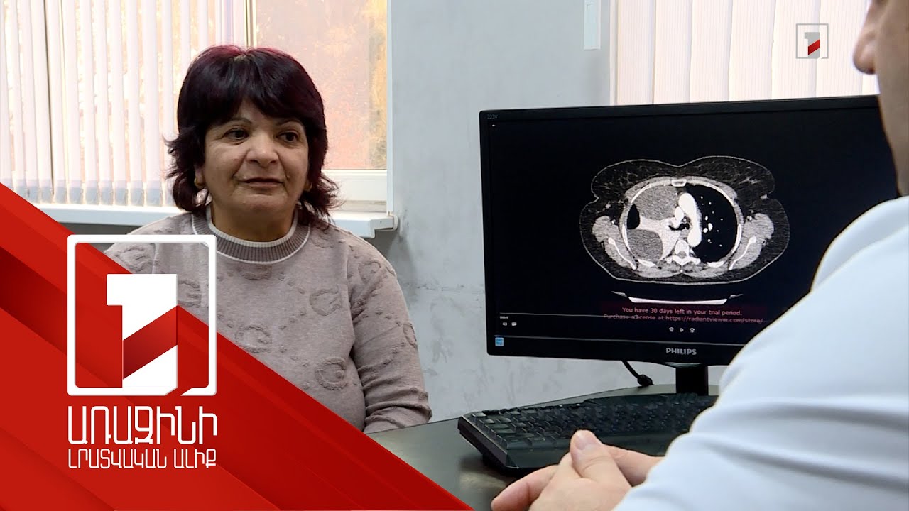 Աշխարհում հազվադեպ հանդիպող ուռուցք է հեռացվել ՀՀ ԲԿ-ներից մեկում