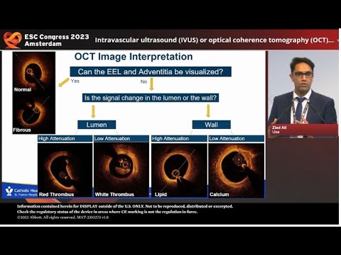 Imaging-Guided (PCI): Evidence Supports A New Standard of Care