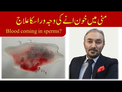Mani ma khoon any ki waja or iska ilaj | Blood in sperm | Hematospermia | By Dr Fartash Sarwar