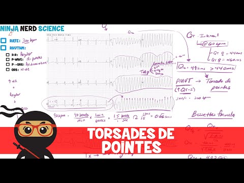 Rate and Rhythm Normal Sinus Rhythm