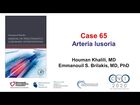 Case 65: PCI Manual - Arteria lusoria and STEMI