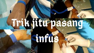 Download lagu How to install an infusion, how to install a vemplon, how to stab a vein mp3