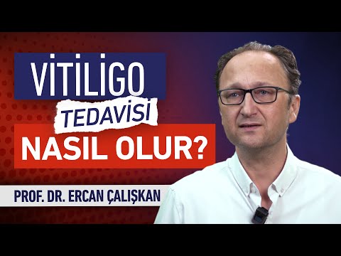 Vitiligo Tedavisinde Neler Yapılır | Prof. Dr. Ercan Çalışkan