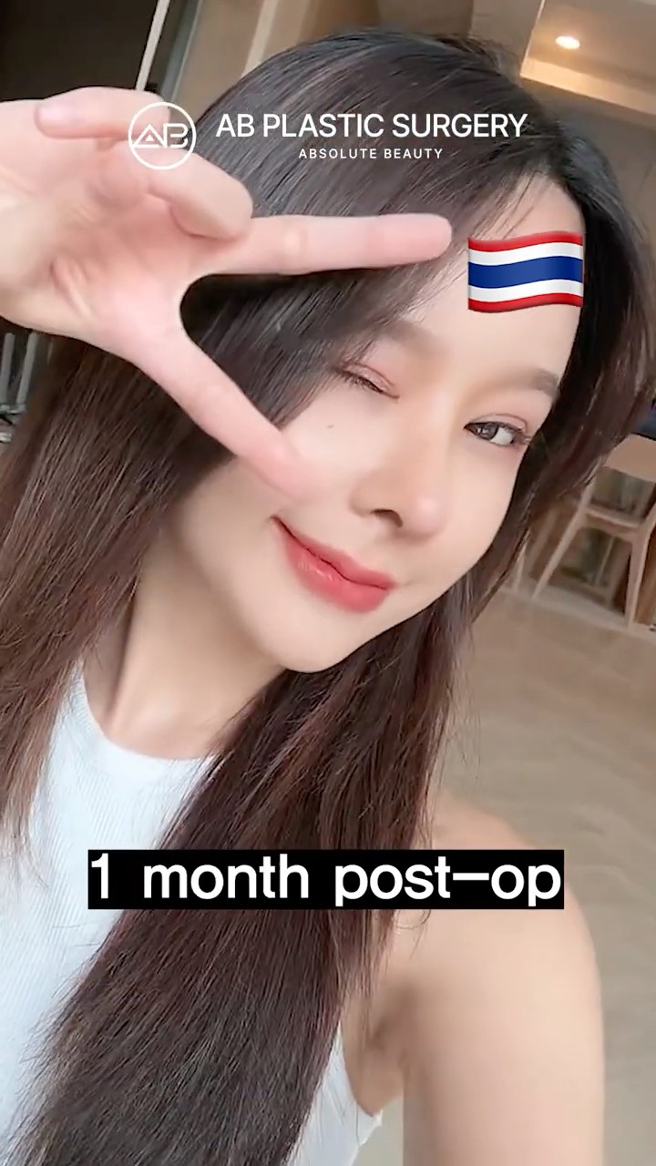 One Trip, Three Surgeries Glow Up in Korea