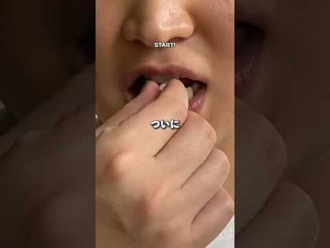 テムズ 20 号線の避妊薬を飲むと太りますか、それとも痩せますか?