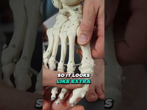 TOP 13 Ways to Shrink Bunions Naturally 1 HUGE SECRET