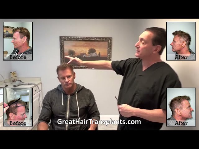 Dr. Brett Bolton Patient Kevin MaxHarvest&trade; Plus

