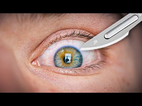 Last Video Before Someone Cuts In My Eye