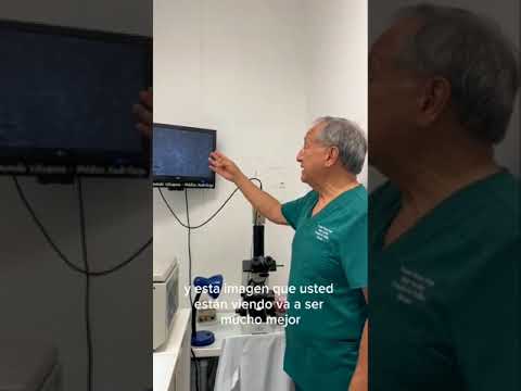 ¿Cómo se hace una Inseminación Intrauterina? Dr. Fernando Vásquez