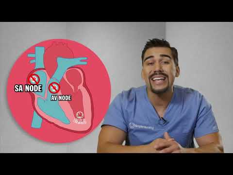 EKG l Ventricular Tachycardia (V Tach)