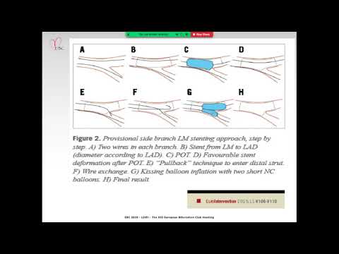 The Provisional pathway, it's pitfalls & the EBC Philosophy - Dr Jens Lassen