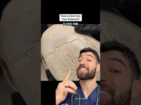 POV: You’re Anemic for Too Long