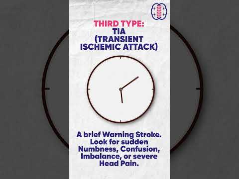 Stroke Warning Signs You Must Never Ignore | 3 Types of Stroke Explained | Dr Garga Basu