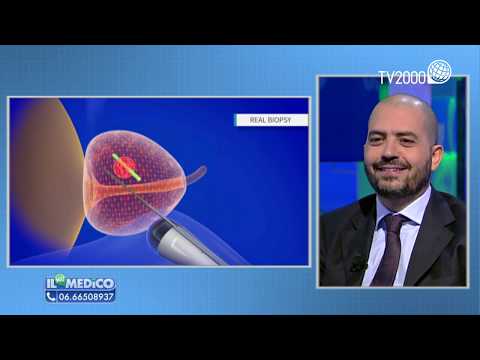 posso rimanere incinta se mio marito ha la prostatite posso rimanere incinta se mio marito ha la prostatite