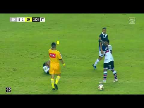 André Lima - 13.11.2020 - Remo 0 x 2 Santa Cruz - Brasileiro Série C - 15ª Rodada