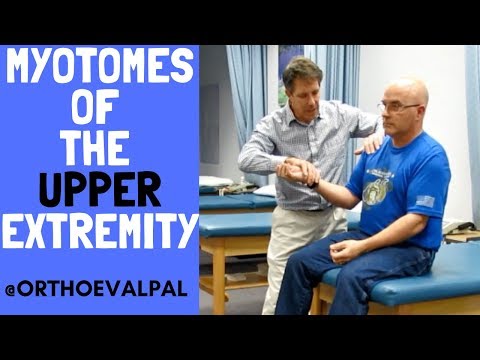 Positive Hoffman s Sign Hyperreflexia and Spurling s Test