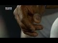 ALCS Gm1: Escobar has a busted fingernail
