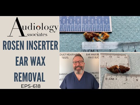 ROSEN INSERTER EAR WAX REMOVAL - EP618