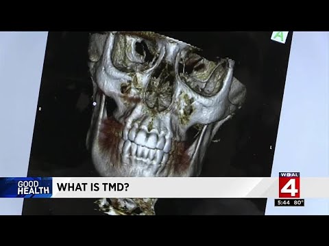 Good Health: What is TMD?