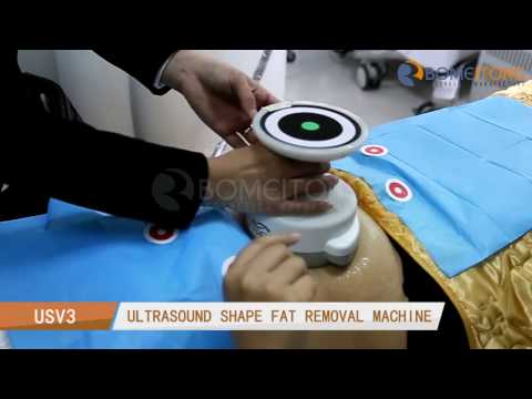 Bomeitong 3D Ultrashape Slimming System Operation Video USV3