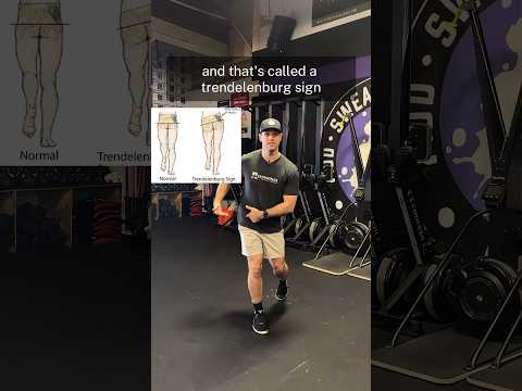 Hip Abductor Strength and Runners #running #runner #hipstability #trendelenburg