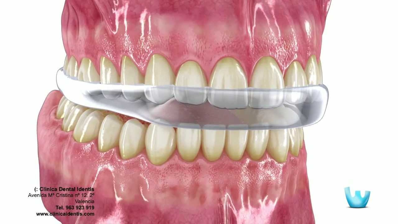 Jose David Torres Hernandez-32