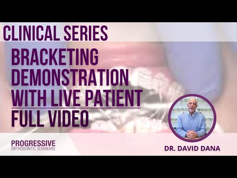 Bracketing Demonstration with Dr. Dana (Full Video, Clinical Series)