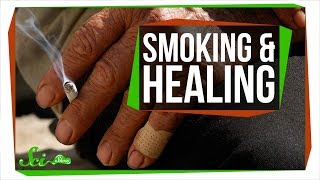 Why Smoking Makes It Harder to Heal