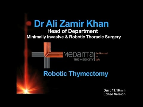 Robotic Thymectomy - Edited version