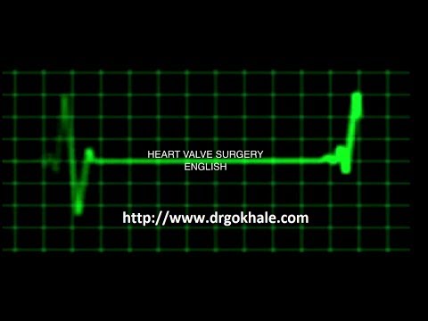 Patient Education on Heart Valve Surgery Video - English Version | Dr Alla Gopala Krishna Gokhale