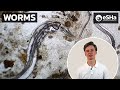 Microscopic Fecal Examination Worms PART 1