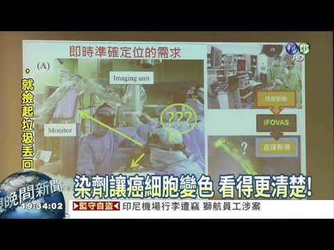 癌細胞顯影新技術 追殺更精準!