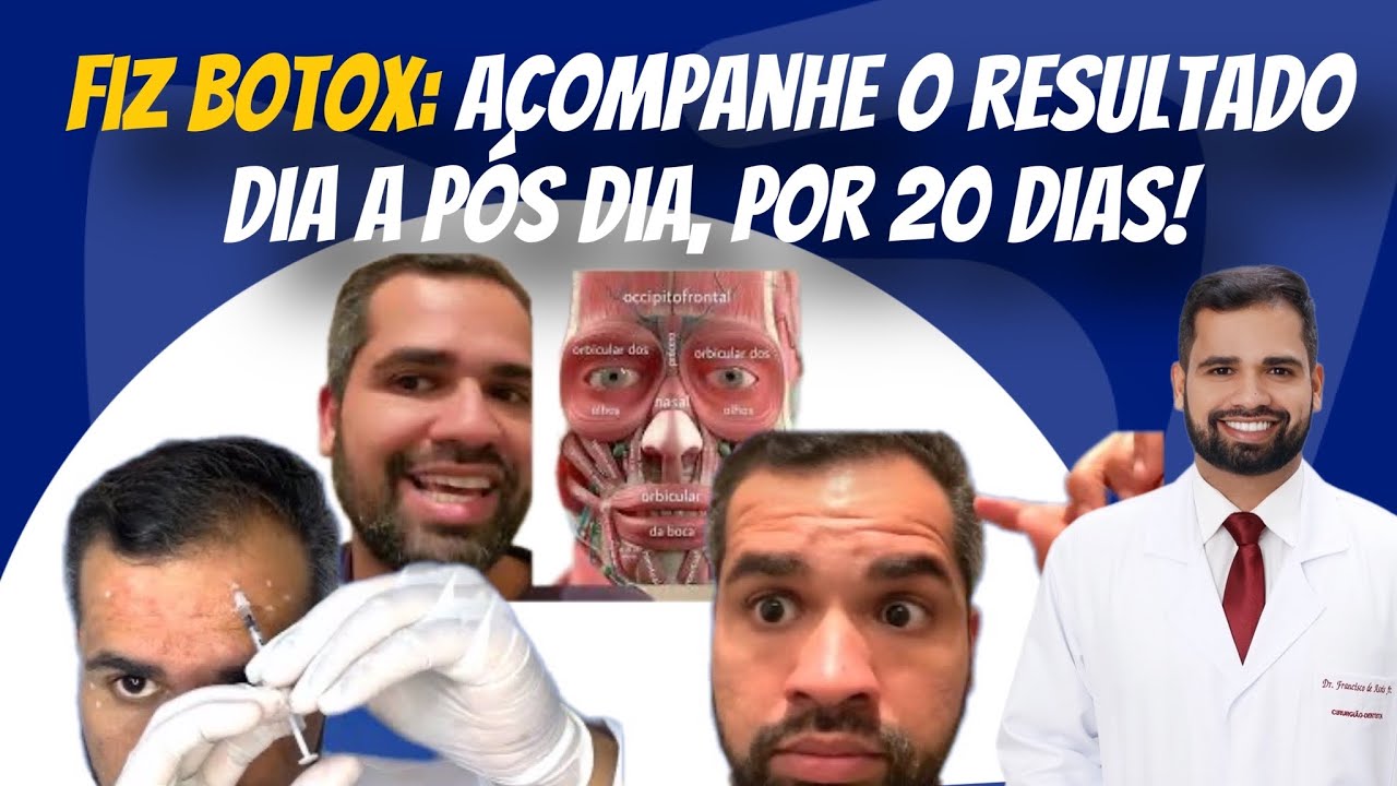 Francisco De Assis Almeida Lima Júnior-59