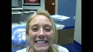 preview picture of video 'Big Chipped tooth or small chips in teeth grove city -Mamelons shaved off  YEA!!!!'