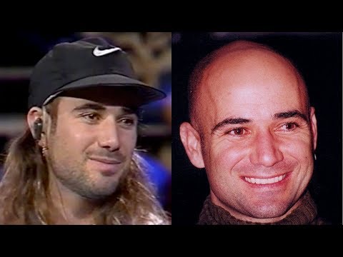 GOING BALD AT 20 - Andre Agassi Balding Case Study