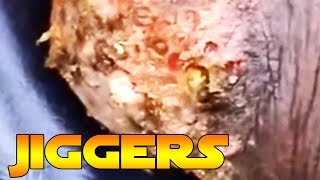 Poppy Pop Popping Part 4 - Risi Jigger Removal - Plus Brain Gainz Multivitamin1