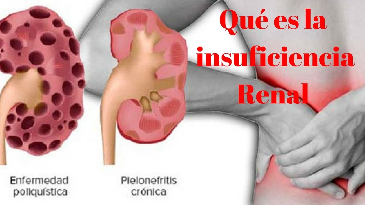 Cristobal Tomas Buitrago Gutierrez-3