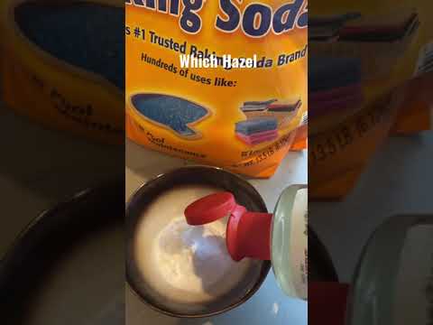 How to stop Bug bites from itching #shorts