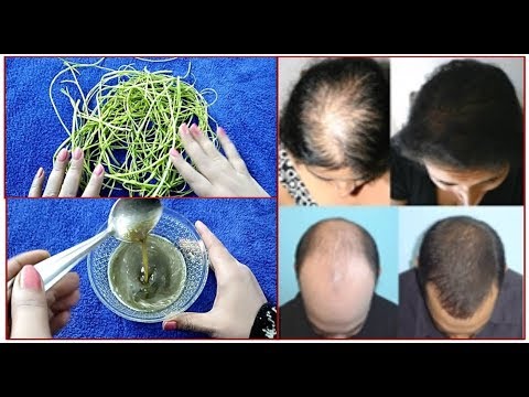 download lagu mp3 mp4 Amar Bail Hair Oil, download lagu Amar Bail Hair Oil gratis, unduh video klip Download Amar Bail Hair Oil Mp3 dan Mp4 Free All Gratis