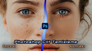 Photoshop Profesyonel Yüz Temizleme yapmak. Photoshop Cilt Temizleme nasıl olur?