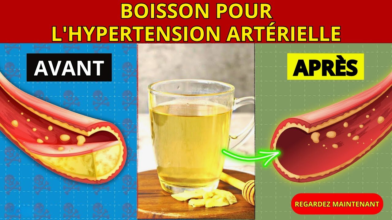 Boissons qui normalisent l'hypertension artérielle et nettoient les artères