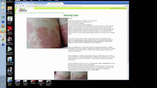 preview picture of video 'Student Skin Consult -Diagnosing Skin Disease'