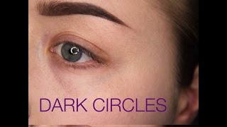 HOW TO COVER UP DARK UNDER-EYE CIRCLES
