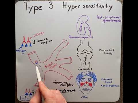 Type 3 hypersensitivity reaction in 2 mins!